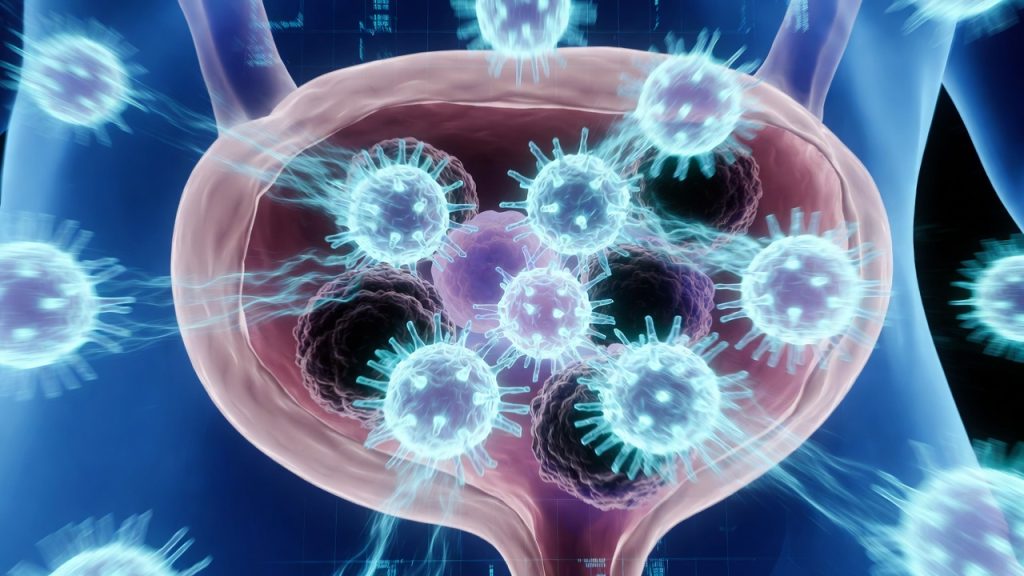 Bladder cancer treatment innovations in 2026 with immune cells targeting tumors